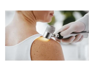 BENU a prevence melanomu: Jak na to správně?